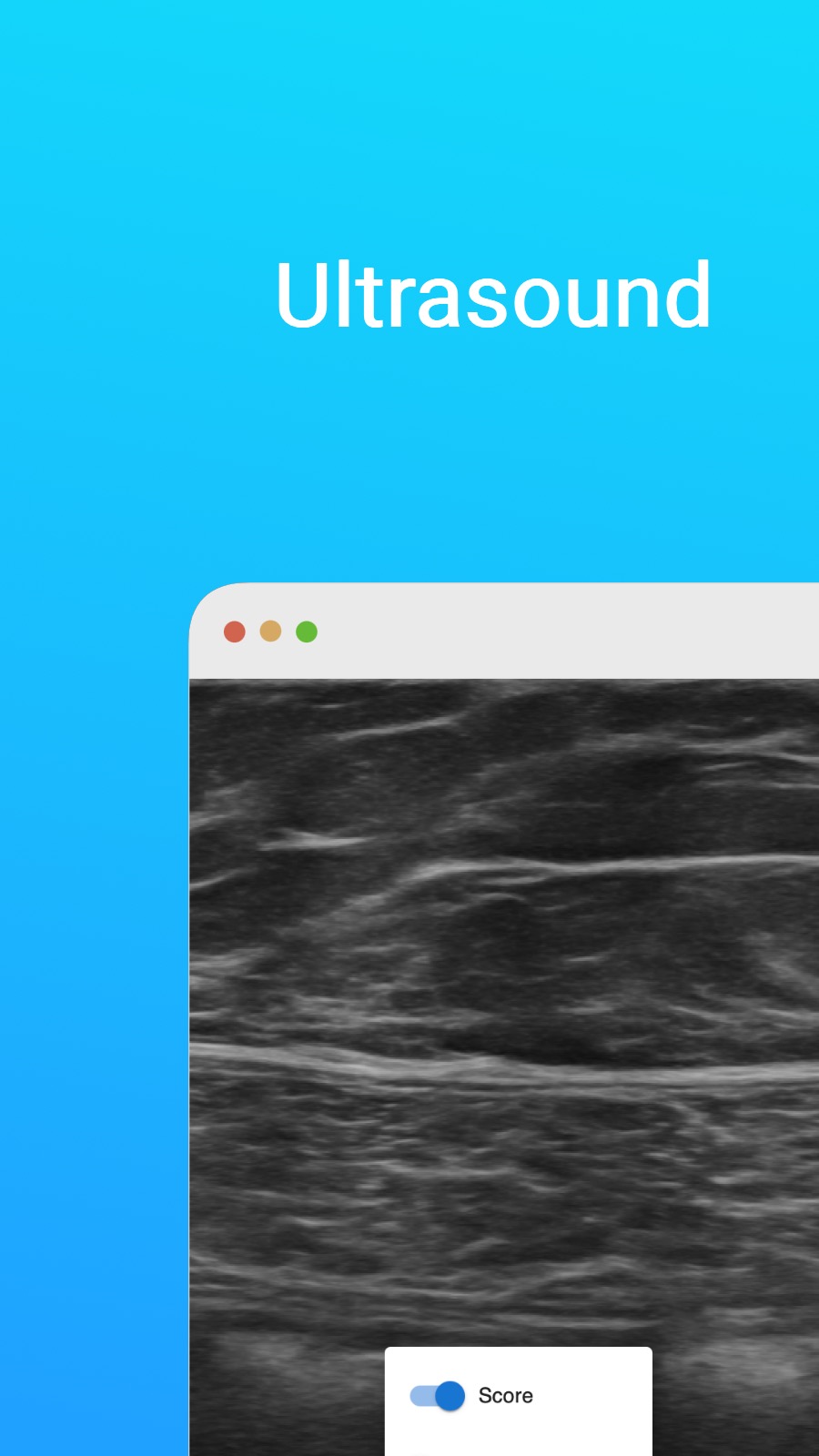 Ultrasound