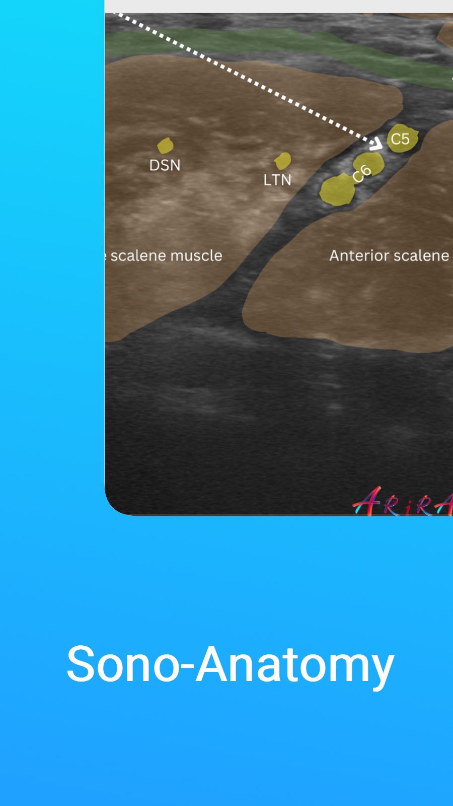 Sono-Anatomy